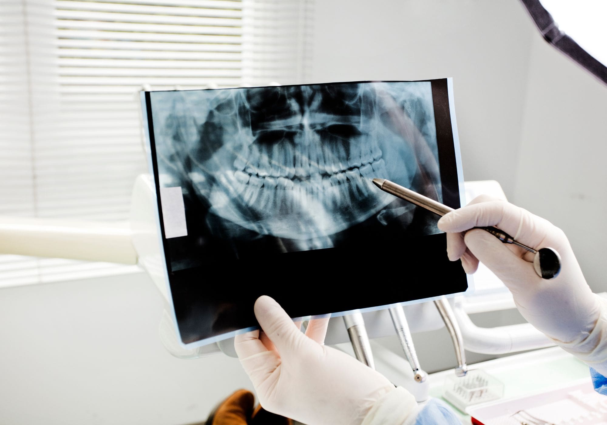 X-Ray
